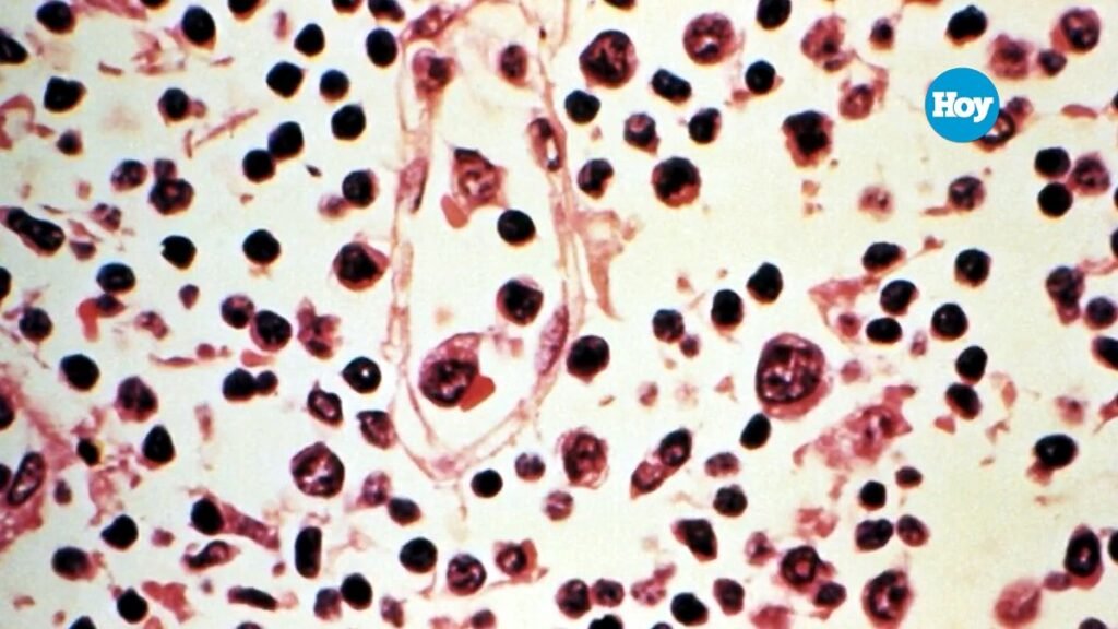 La OMS sitúa en seis los casos de hantavirus en el Hondius mientras persisten las pesquisas sobre el brote: en contexto